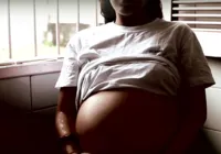 PL do aborto pode igualar leis do Brasil a do Afaganistão e Indonésia