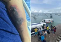 Turista morre após ser picado por suposta aranha em Morro de São Paulo