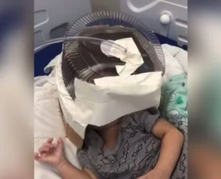 Hospital do RN usa embalagem de bolo como máscara de oxigênio em bebê