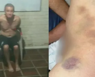 Paciente idoso morre após ser espancado em clínica de reabilitação