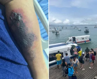 Turista morre após ser picado por suposta aranha em Morro de São Paulo