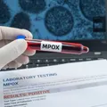 Vacina contra mpox apresenta 84% de eficácia após uma dose, diz estudo imagem
