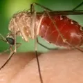 Bebê nasce com anomalia congênita associada à Oropouche e não sobrevive imagem