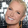 Equipe de Xuxa revela estado de saúde da famosa e explica cirurgia imagem