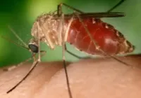 Bebê nasce com anomalia congênita associada à Oropouche e não sobrevive imagem
