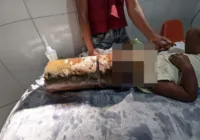 Criança de dois anos prende cabeça em tubo de metal e causa pânico