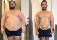 Ex-MasterChef perde 80 kg sem cirurgia e impressiona com fotos