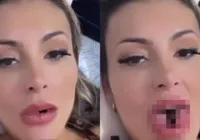 Língua de cobra: Saiba quanto custou cirurgia de Andressa Urach