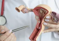 Janeiro Verde: saiba como prevenir o câncer de colo no útero e o HPV imagem