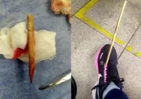 Mulher é atingida por flecha em área hospitalar de Belo Horizonte