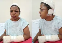 Mulher tem rosto rasgado com golpes de facão pelo 'ex' na Bahia