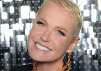 Equipe de Xuxa revela estado de saúde da famosa e explica cirurgia imagem