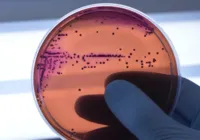 Salmonella: conheça bactéria que 'barrou' marca popular de bala