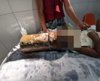 Criança de dois anos prende cabeça em tubo de metal e causa pânico