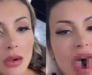 Língua de cobra: Saiba quanto custou cirurgia de Andressa Urach