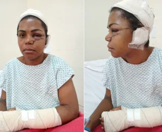 Mulher tem rosto rasgado com golpes de facão pelo 'ex' na Bahia