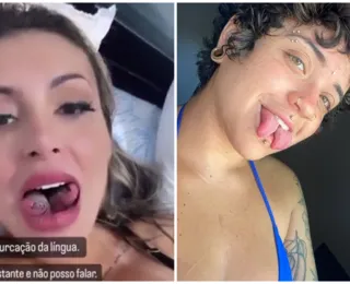 'Não vejo diferença no sexo', diz baiana com língua igual a Urach