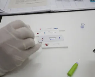 Caso HIV: Ministério da Saúde determina novos testes em doadores