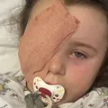 Garotinha de 7 anos perde olho ao ser atingida por estilhaços de vape imagem