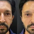 Ricardo Nunes faz procedimentos estéticos; veja antes e depois imagem