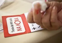 Aids: Brasil tem alta de casos, mas menor mortalidade desde 2013 imagem