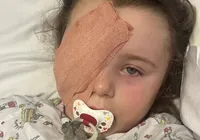 Garotinha de 7 anos perde olho ao ser atingida por estilhaços de vape imagem