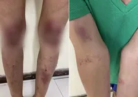 Mulher é torturada e arrastada de joelhos com coleira de cachorro por traficantes