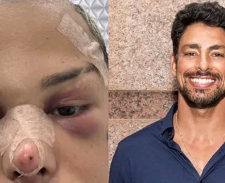 Influencer gasta fortuna para ficar igual a Cauã Reymond; veja resultado