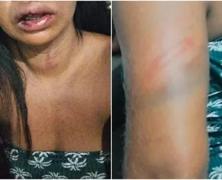 Mulher é agredida por atrasar 12 minutos para buscar companheiro