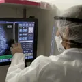 Câncer: diagnóstico precoce pode elevar em 90% as chances de cura imagem