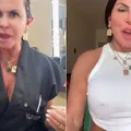 Com alopecia, Gretchen aparece sem mega hair: "Realidade" imagem