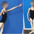 Pais são condenados após filha de 20 chegar a 27 quilos imagem