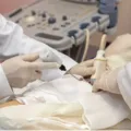Universidade brasileira testa técnica inédita contra câncer de mama imagem