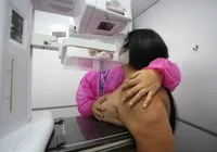 Instituições de Saúde se mobilizam por mamografia de rastreio desde os 40 anos imagem