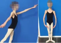 Pais são condenados após filha de 20 chegar a 27 quilos imagem