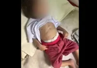 Pais são presos após bebê de 1 ano morrer por desnutrição grave imagem