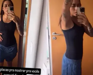 MC Loma celebra mudanças no corpo após cirurgia: "Sonho"