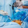 Cirurgia bariátrica tem novas regras; veja o que mudou - Imagem