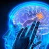 Implante cerebral de mulher transforma seus pensamentos em fala - Imagem