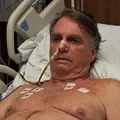 Após uma semana internado, Bolsonaro mostra pontos no abdômen imagem