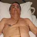 Boletim: Bolsonaro tem quadro de saúde atualizado imagem