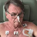 Bolsonaro tem drenos retirados; confira quadro de saúde imagem