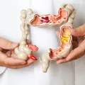 Câncer colorretal: cirurgia robótica revoluciona tratamento imagem