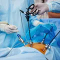 Cirurgia bariátrica tem novas regras; veja o que mudou imagem