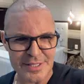 Eduardo Costa surge completamente careca e decide revelar o motivo imagem