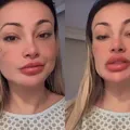 Fortuna? Andressa Urach revela quanto gastou com três dias de internação imagem