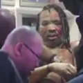 Homem tem rosto desfigurado ao ser incendiado na Times Square imagem