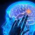 Implante cerebral de mulher transforma seus pensamentos em fala imagem