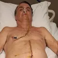 Justiça procura Bolsonaro na UTI para informar sobre julgamento imagem