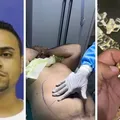 Líder do CV no Rio passou por lipo e tirou bala da cabeça em casa imagem